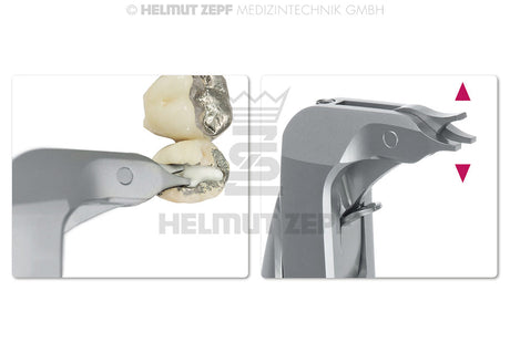 Crown Remover Instrument ZEPF Crown-Spreading Pliers 14.5cm Xcision-Line® Handle by Helmut Zepf No.19.277.01Z